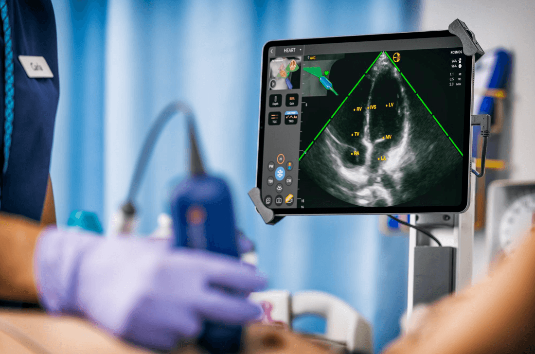 Can AI Help Detect Hidden Heart Disease Years Before Symptoms Appear?