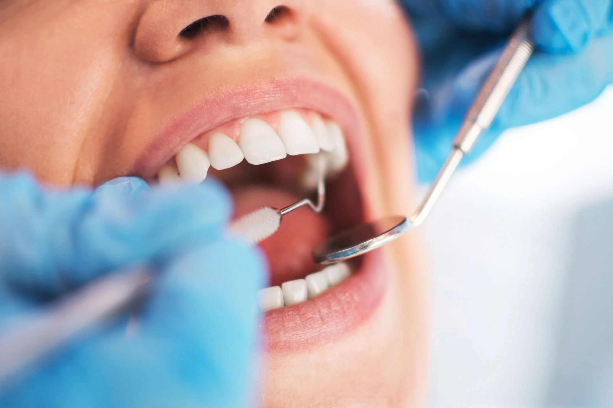 The Relationship Between Dental Caries and Quality of Life in Young Children