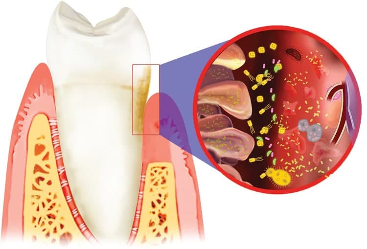 More Than Teeth: Is Oral Health Correlated With Other Diseases?