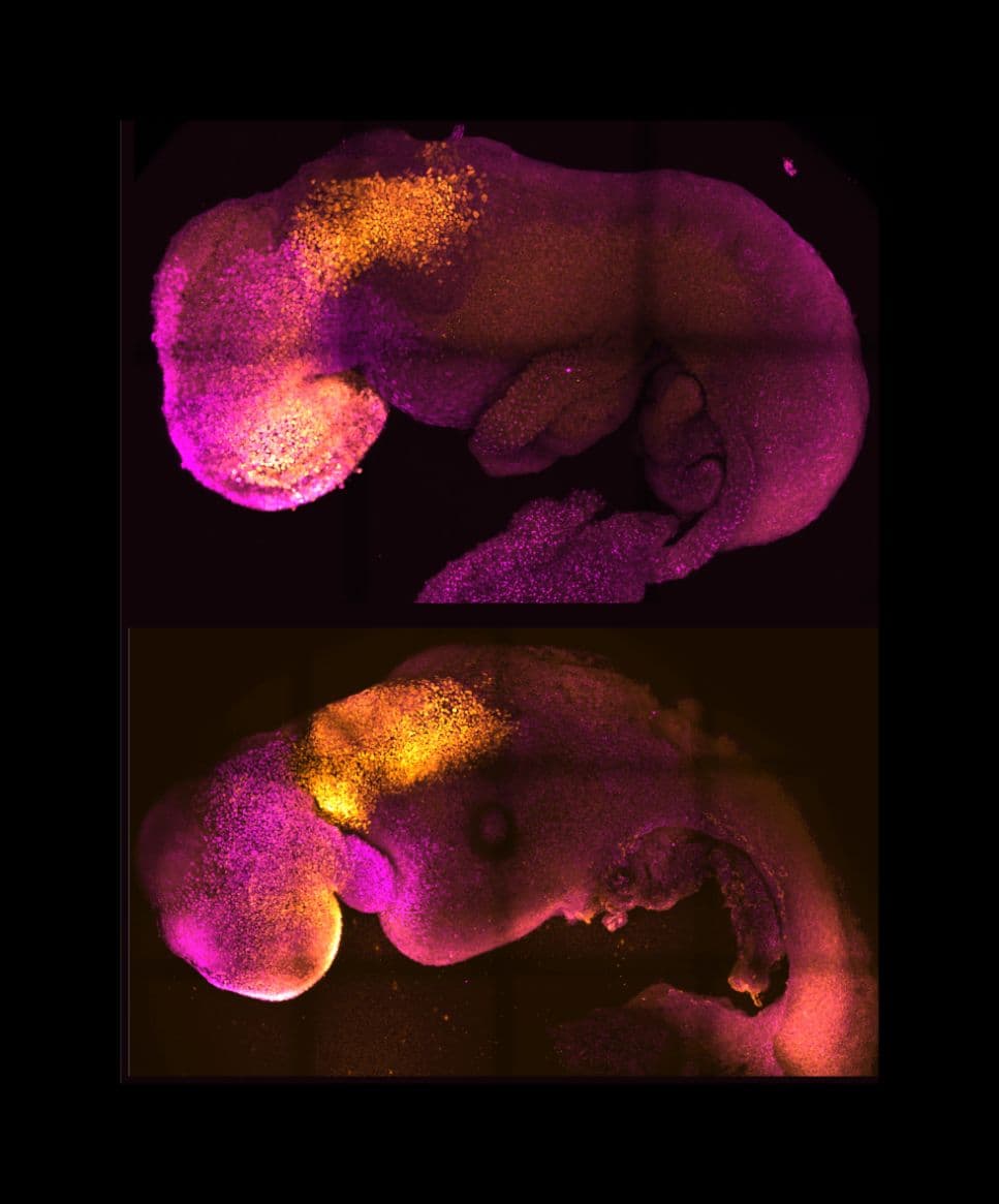 Should we Treat Embryos Made in a Lab the Same as Natural Embryos?